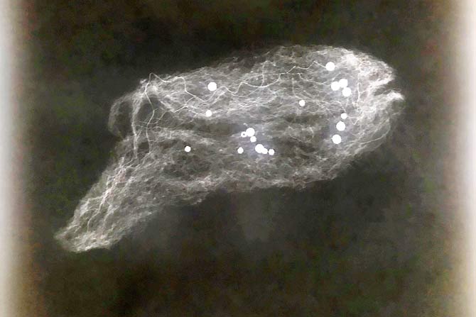 He woke up with seeds in his lungs, X- Ray Films in LED light boxes, 12 x 15 inches, 2020