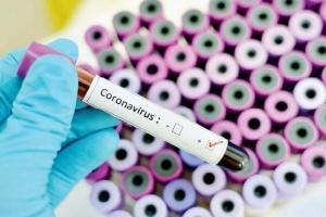 Will take at least 1.5 to 2 years to develop coronavirus vaccine: ICMR