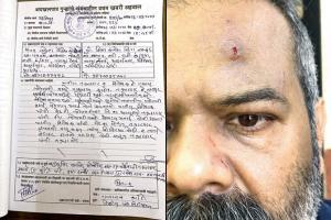 Andheri residents assault secretary over visitor entry