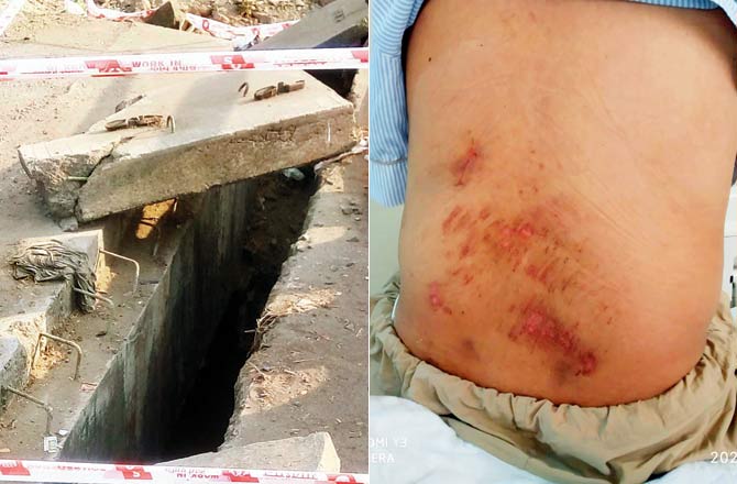The partially covered gap that Amol Chavan fell through; Chavan sustained several injuries in the fall Pics/Rajesh Gupta