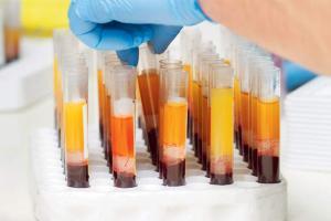 Plasma therapy: To use or not to use...