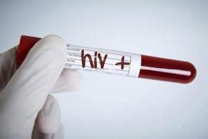 COVID-19 patient with HIV history recovers in 6 days