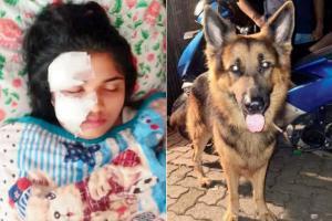19-yr-old bitten by Chembur resident's pet dog gets 49 stitches in face