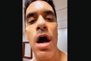Angad Bedi: Moved to wrong side, Sikander's elbow hit my face