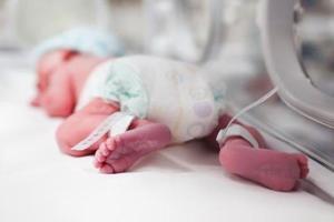 20-day-old child defeats COVID-19 and survives intestine surgery
