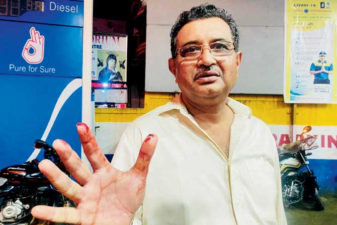 Petrol pump owner Mukesh Patel shows his injuries