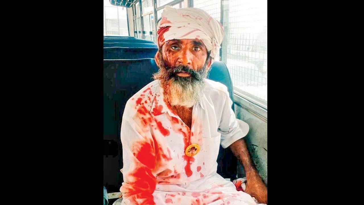 Farmer hurt in Karnal lathicharge dies of heart attack: BKU leader Gurnam Singh Chaduni
