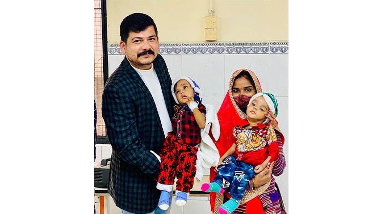 Pawan Singh Gorakhpur provides financial support for separating Conjoined Twins Ram and Shyam