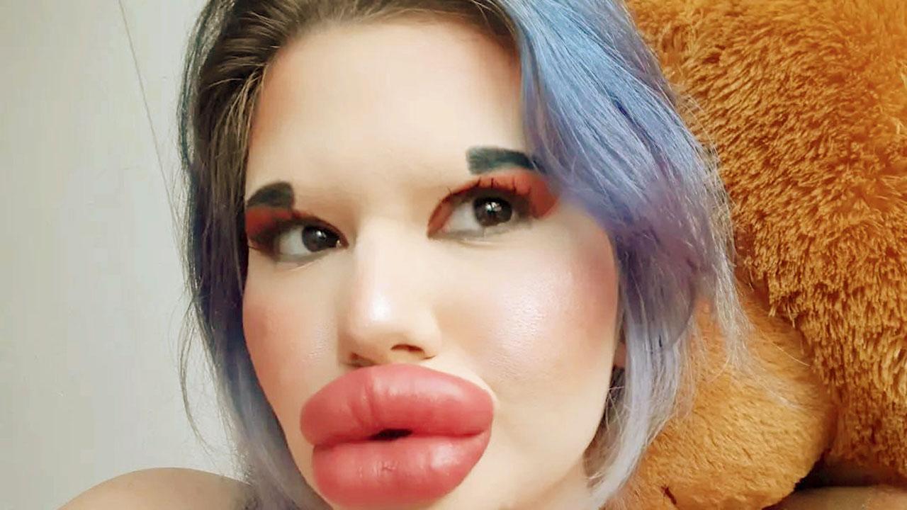 With many fans enamoured by her plump pout