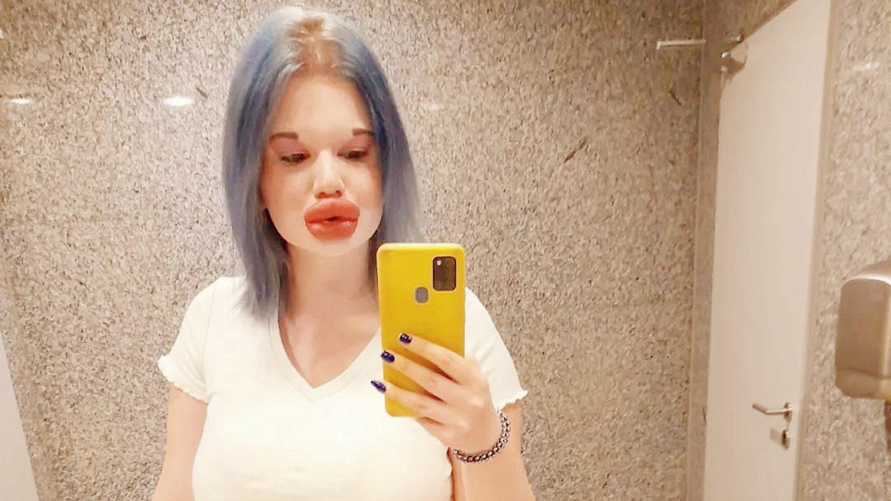 With each of her injections costing around $265, Ivanova has spent more than $5,000 perfecting her pout. Pics/Instagram