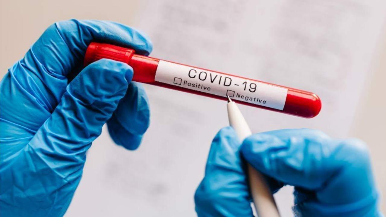 Canada finds first case of Covid-19 in wildlife