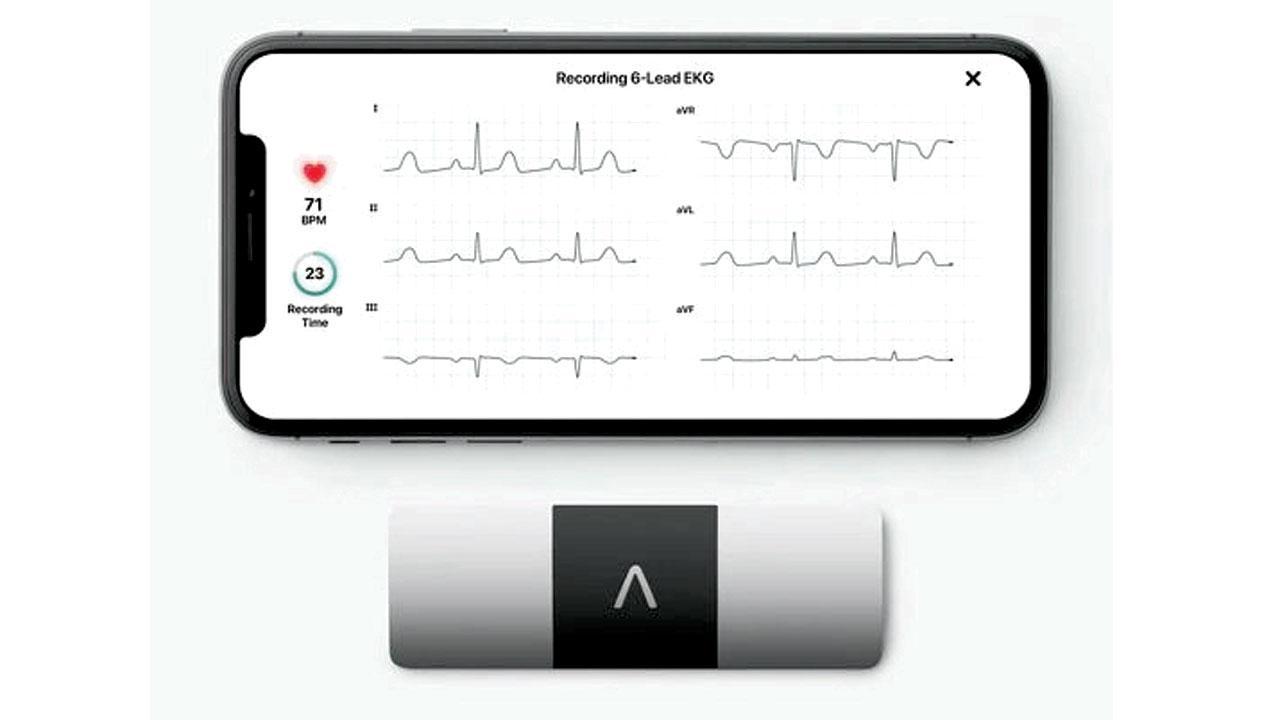 Gadget review: Monitor your heart at home
