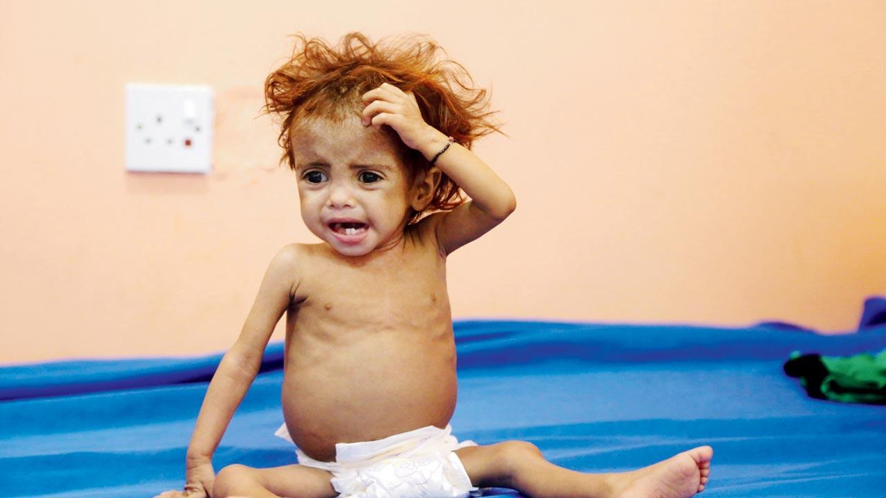 ‘Terror label will devastate impoverished Yemen’