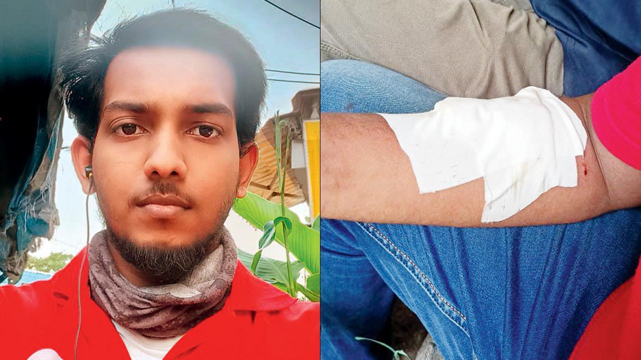 Mumbai: Man attacks food delivery boys with bottle; one badly injured