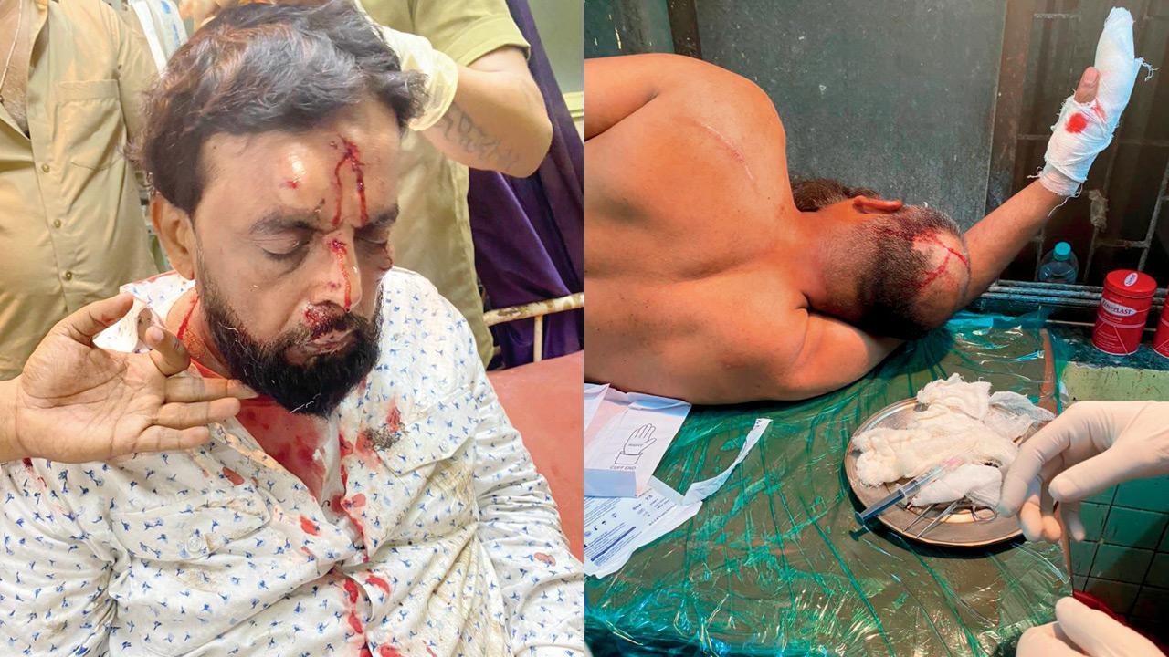 Mumbai Crime: Bandra residents attacked with swords and iron rods