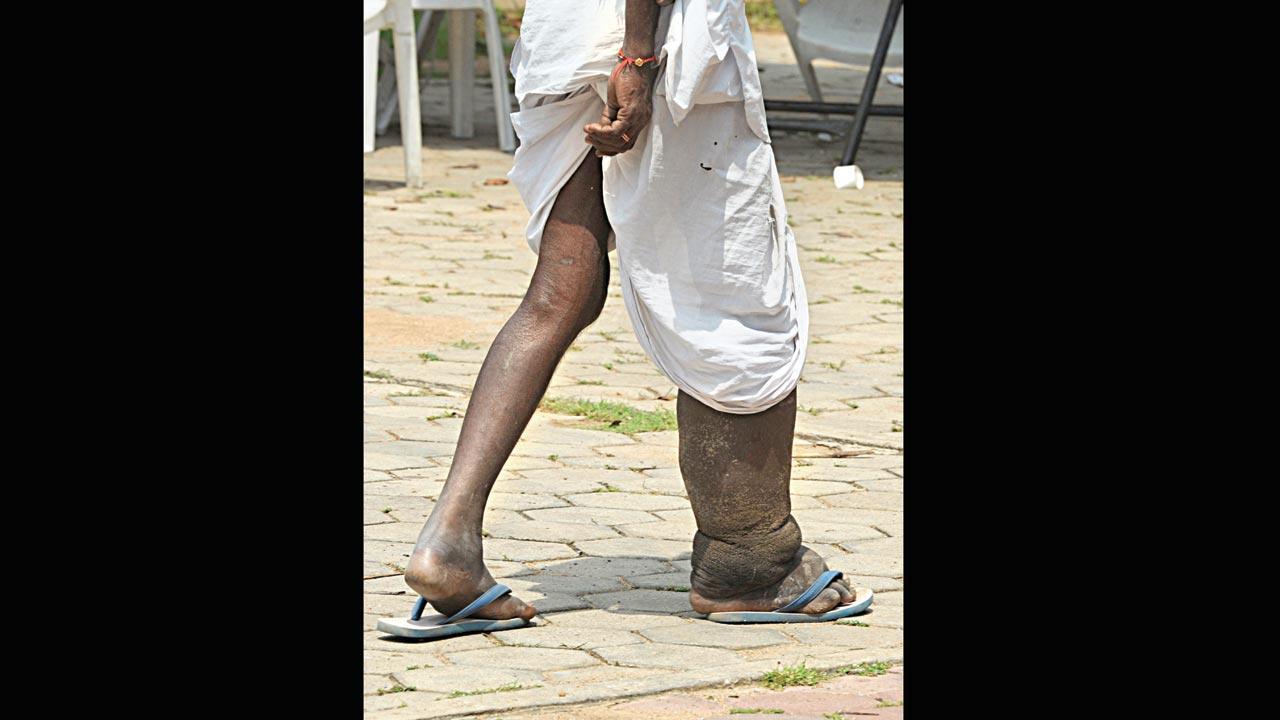 Maharashtra’s other health crisis