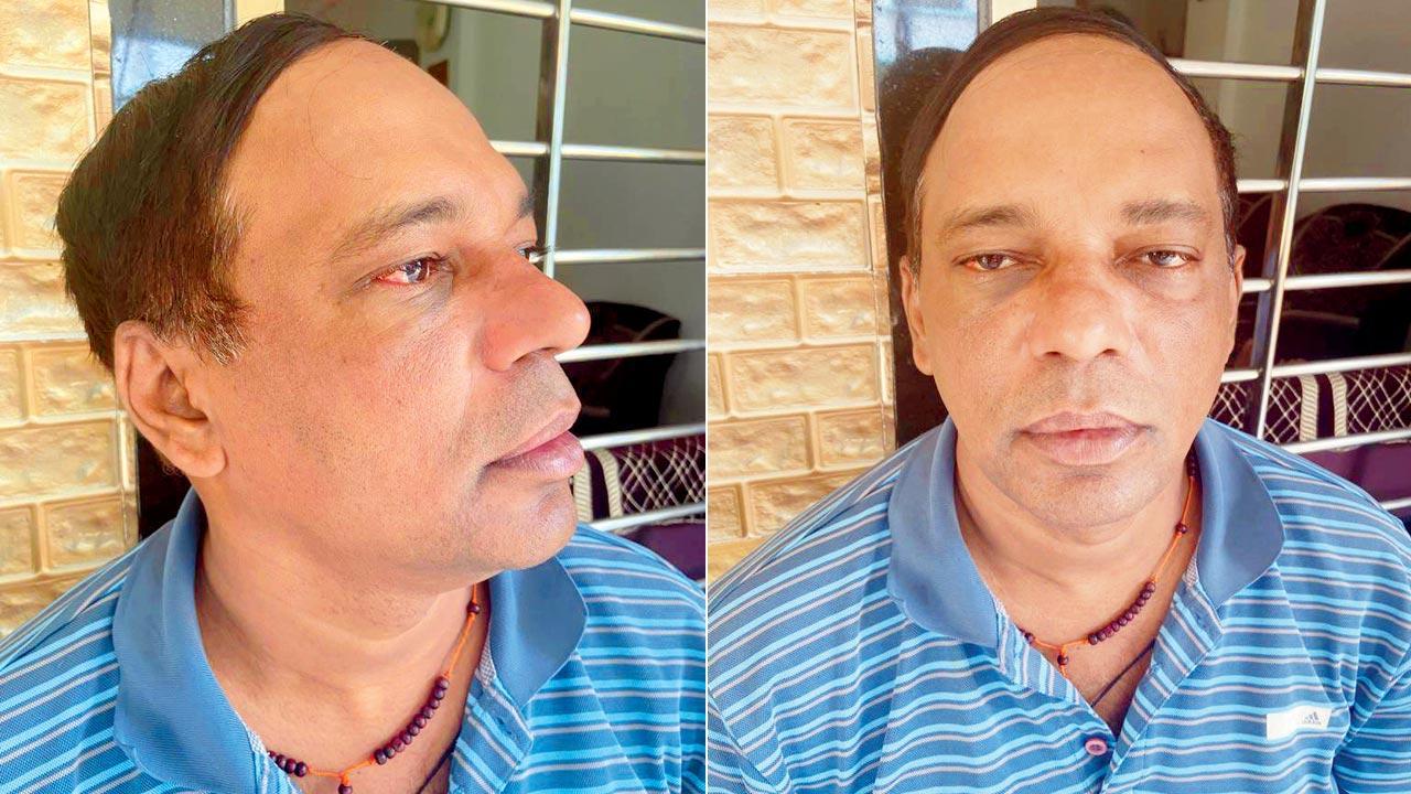 Mistaken for a thief, govt employee beaten by cops in custody