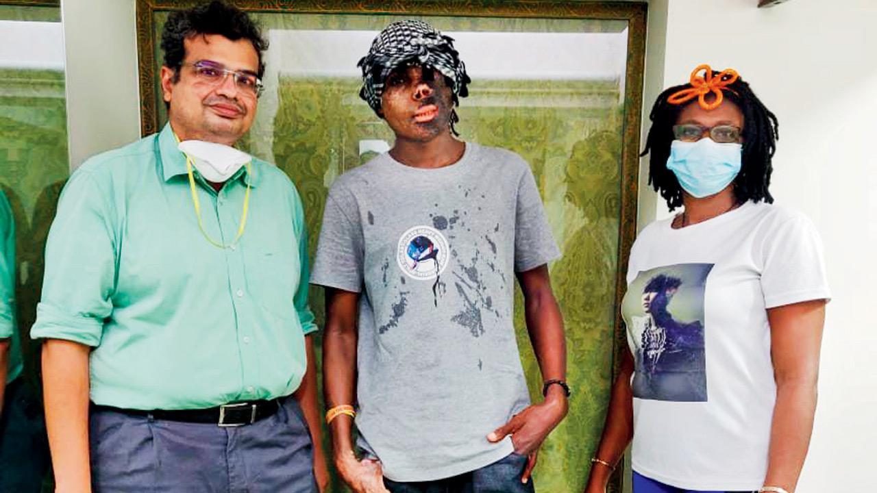 31-year-old burn victim from Central Africa travels 6,600 kms to Mumbai for proper treatment