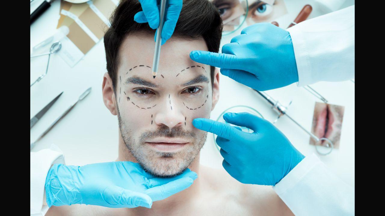 What to consider before opting for a facelift