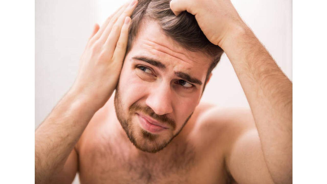 Hair Loss Prevention Tips for Men