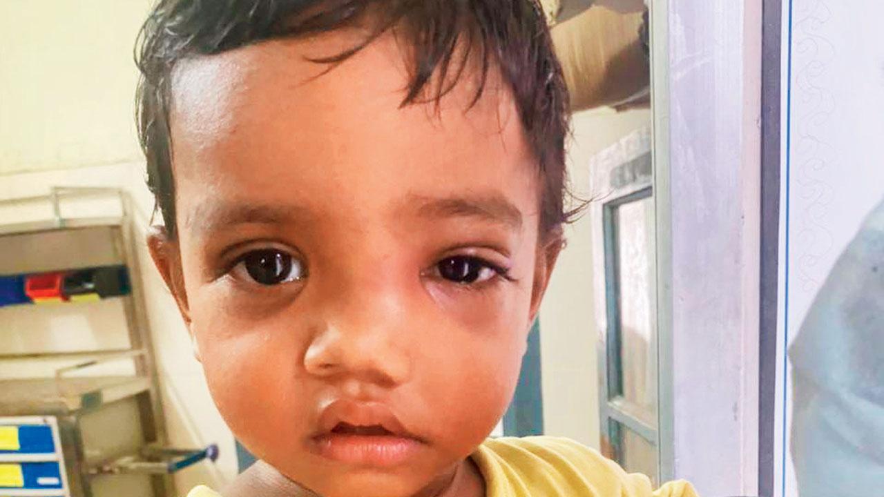 Mumbai: Rising mucormycosis cases in children worry medicos