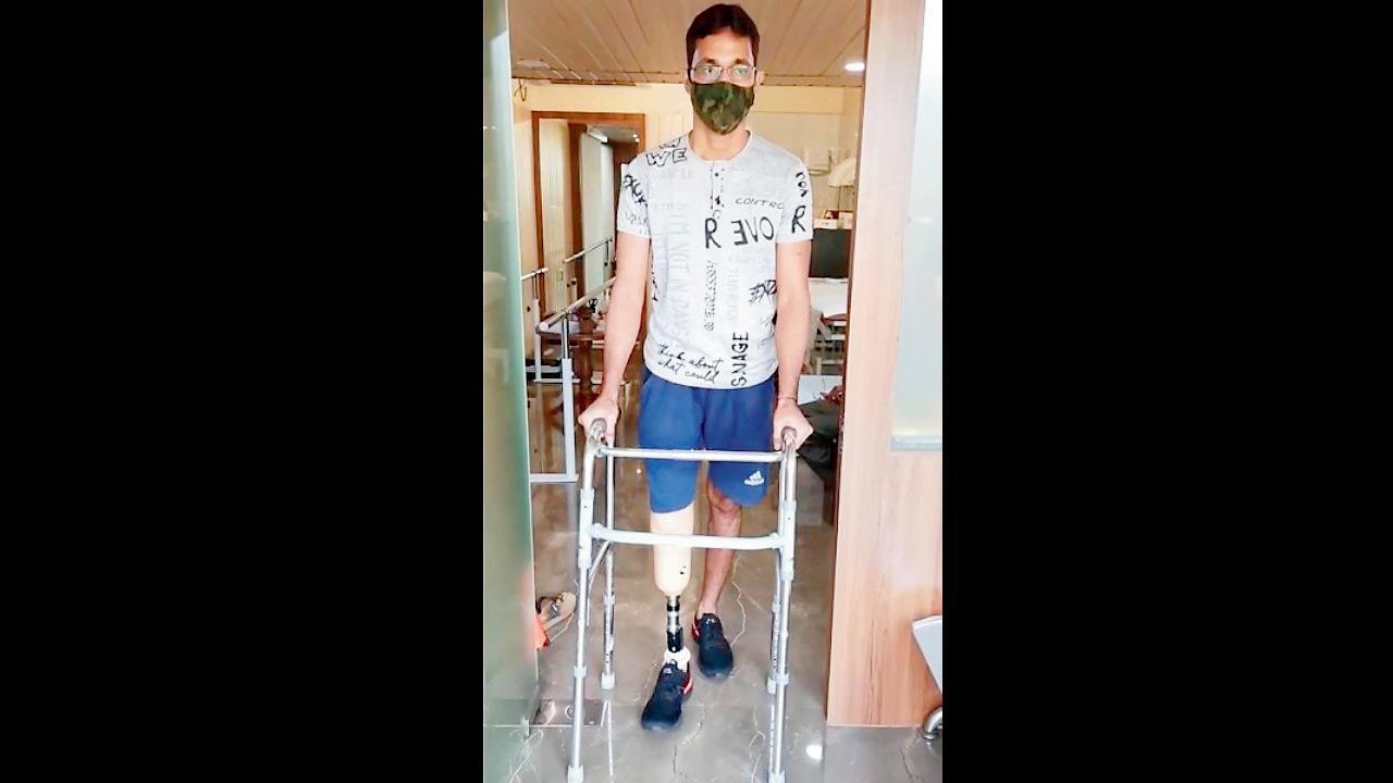 And, he’s back! Mumbai man gets prosthetic limb a year after losing his leg while saving 30 lives