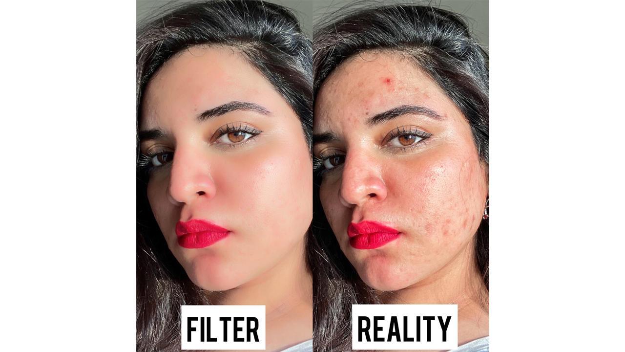 “Raw & Real” Prableen Kaur Bhomrah - India’s First Skin-positive influencer