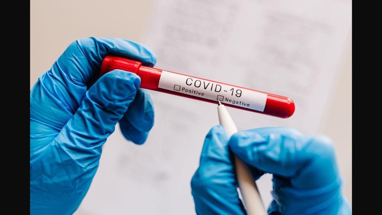 Karnataka: 99 more test positive for Covid-19 at Dharwad medical college, tally reaches 281