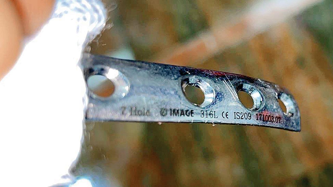 Antop Hill murder: Surgical plate in leg helped cops identify victim