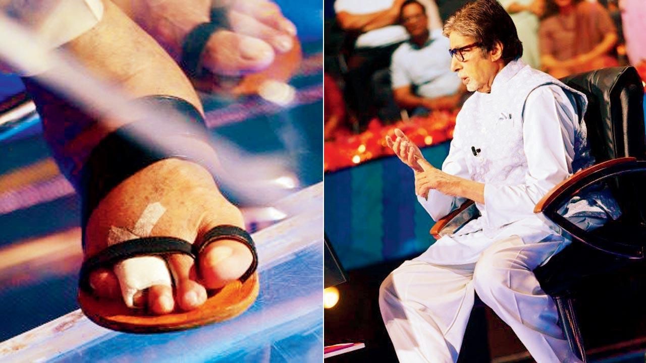 Have you heard? Amitabh Bachchan has fractured a toe