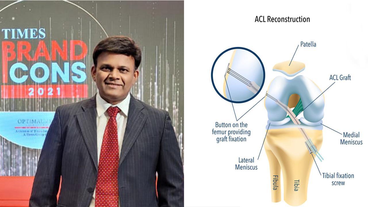 Dr. Samir Pilankar - All you need to know about ligaments : ACL & PCL