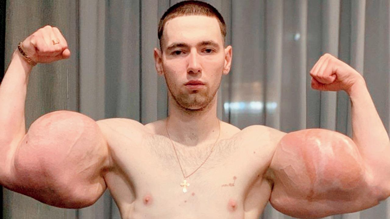 Popeye, the jelly man