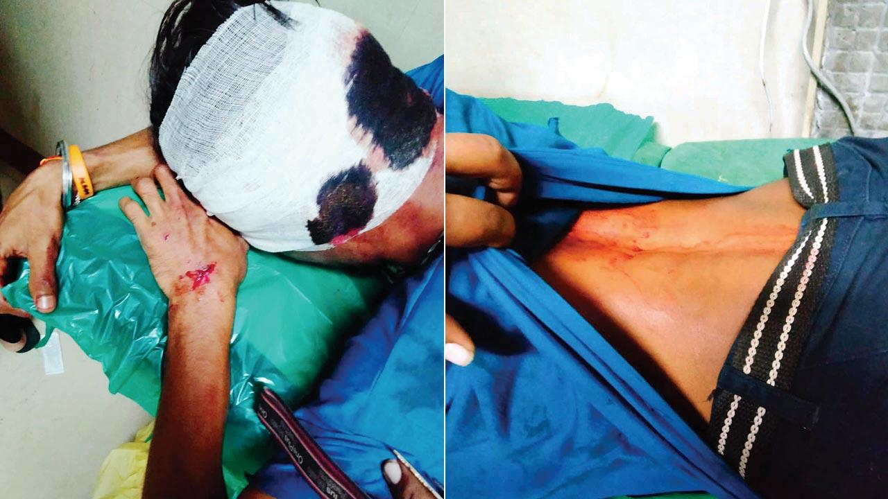 According to locals at Aarey, Rajesh R was attacked by a leopard on Thursday evening