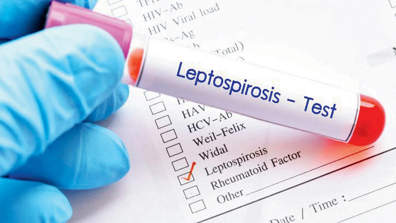 Leptospirosis spreads through the infected urine of animals like rats, dogs, cats and buffalo