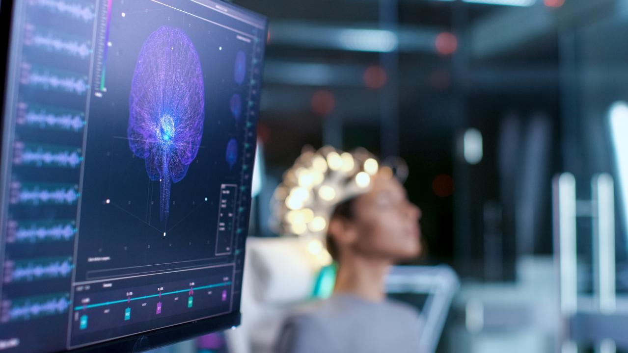 Study reveals that brains with more vitamin D have better cognitive abilities