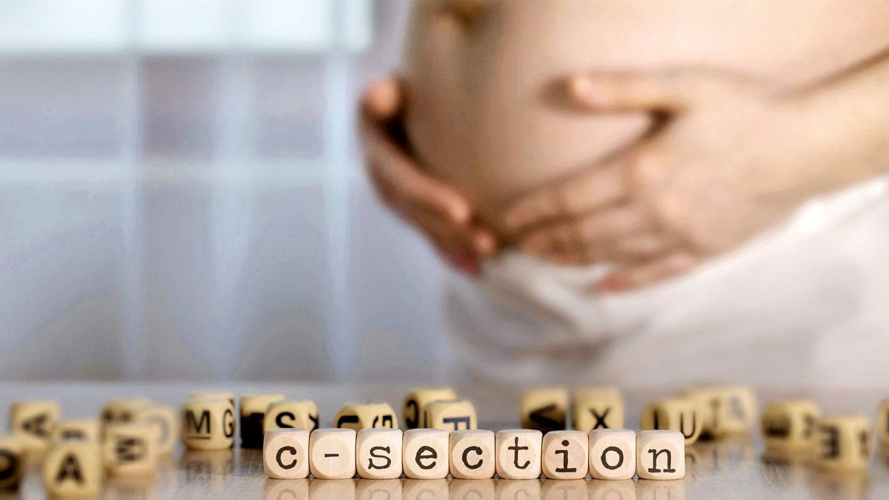 Take steps to reduce C-section deliveries: Health department to doctors