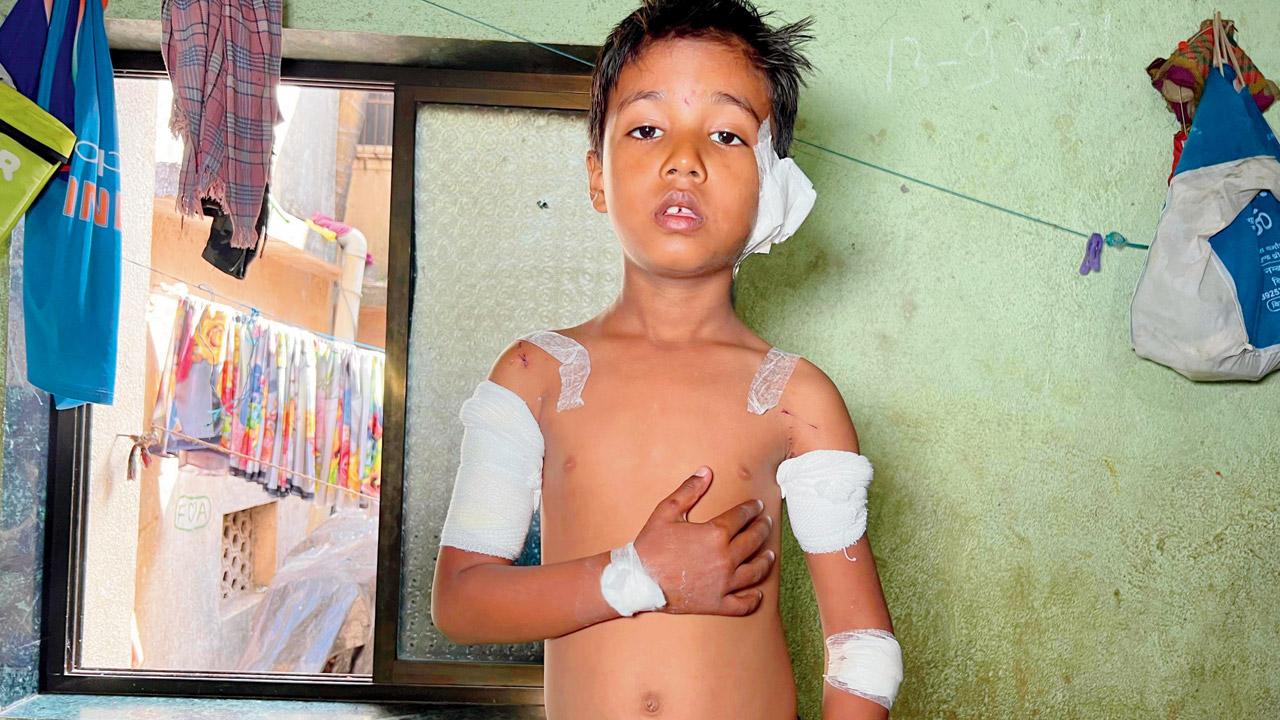Ayush Kushwaha has sustained severe injuries. Pics/Hanif Patel