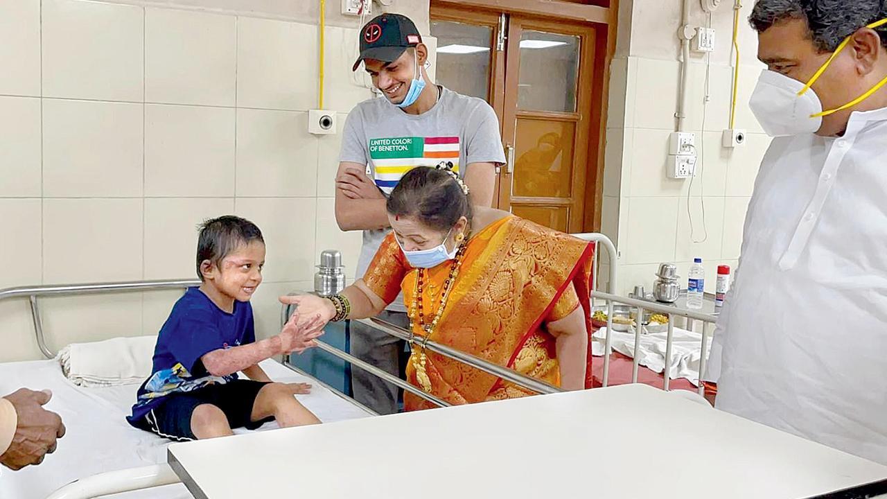 BDD Chawl fire: Five-year-old recovers 80 days after cylinder blast killed family