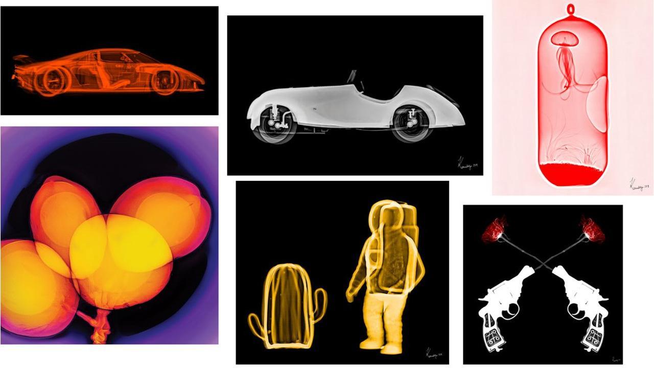 Karmaditya Baldota’s X-ray art exhibition is on show at Nehru Art Center Gallery