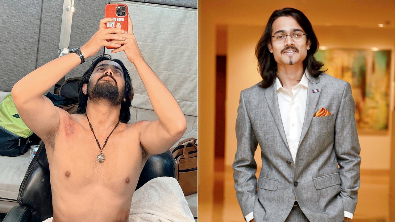 'Taaza Khabar': Bhuvan Bam injures his right arm and shoulder