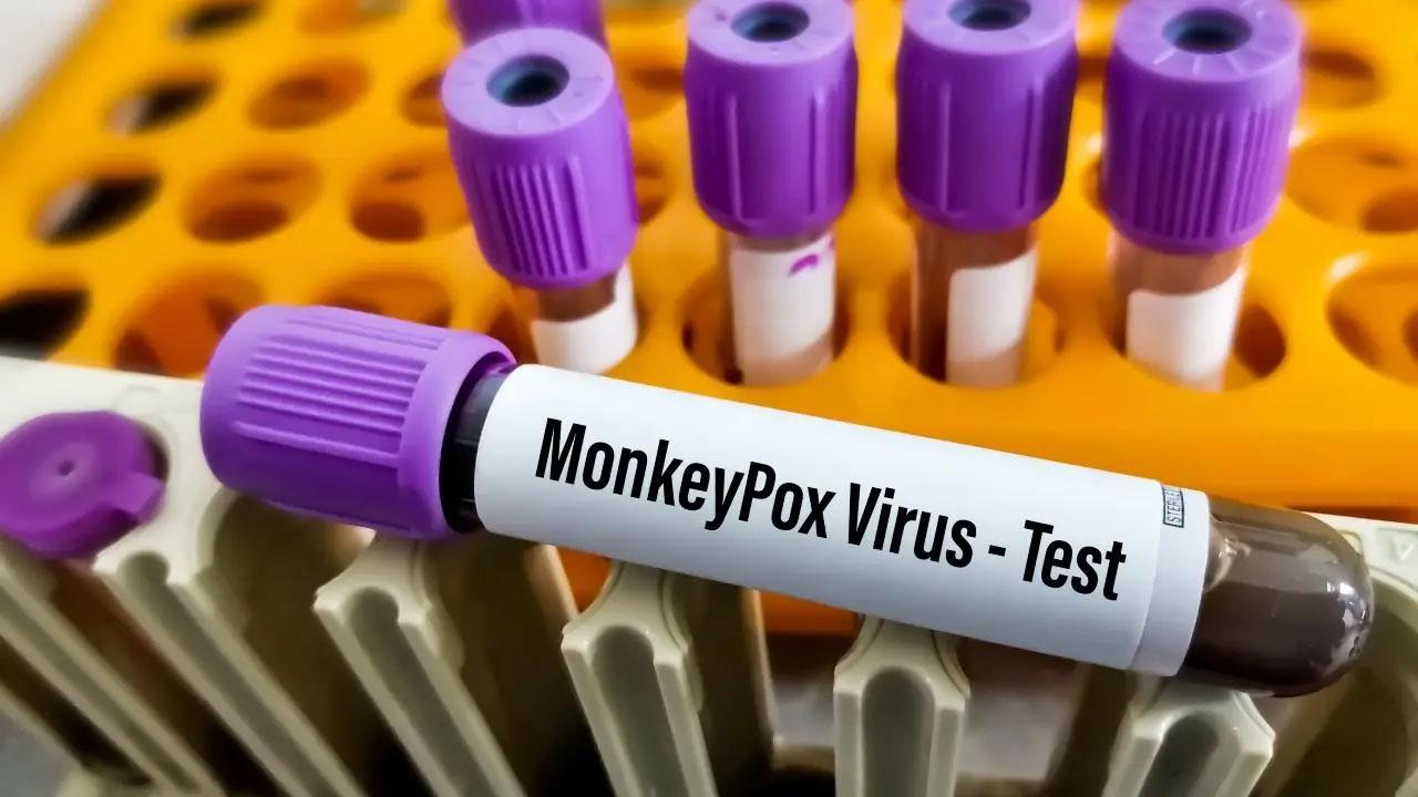 WHO does a u-turn on monkeypox, says unsure whether it can be contained
