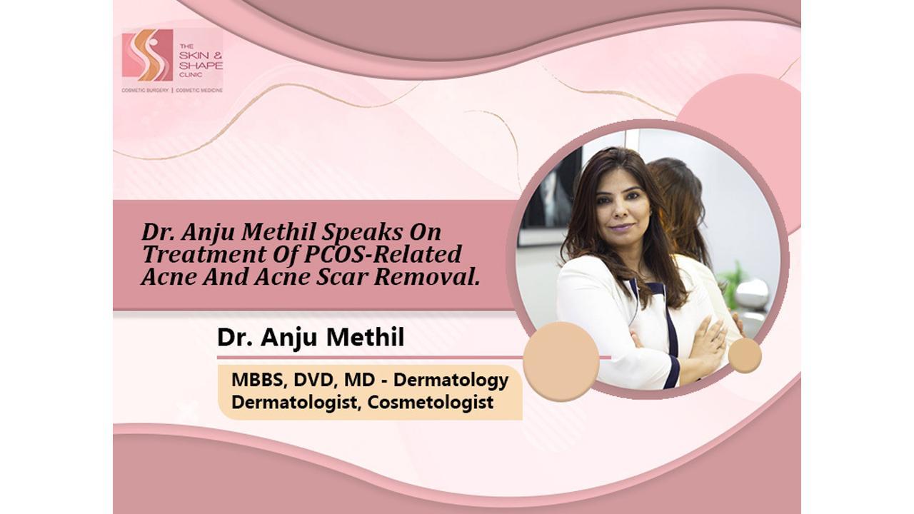 Dr. Anju Methil speaks on Treatment of PCOS-related acne and acne scar removal.