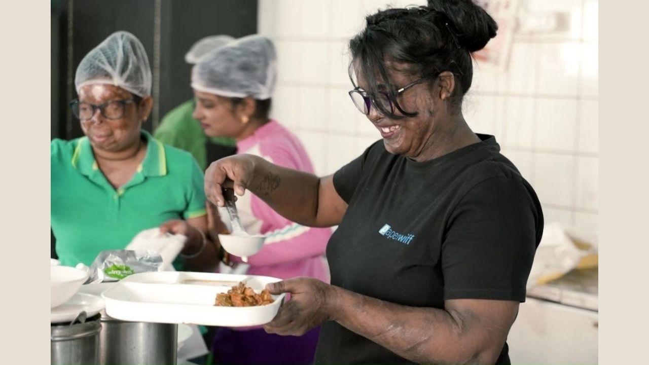 Acid attack survivors need support to break the bias
