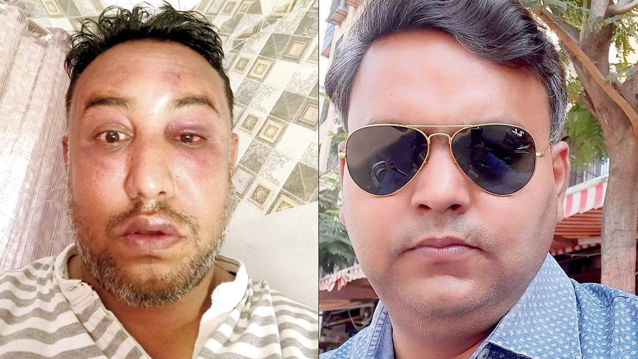 Dixit was assaulted in a moving car on March 16 (right) Accused Rajesh Mishra, who is on the run