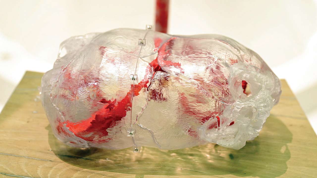 A 3D model of a lung for medical procedures