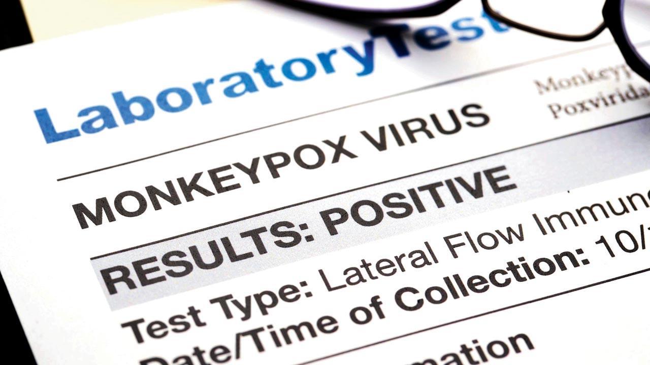Monkeypox: Keep eye on strange rashes, travel history, say health experts