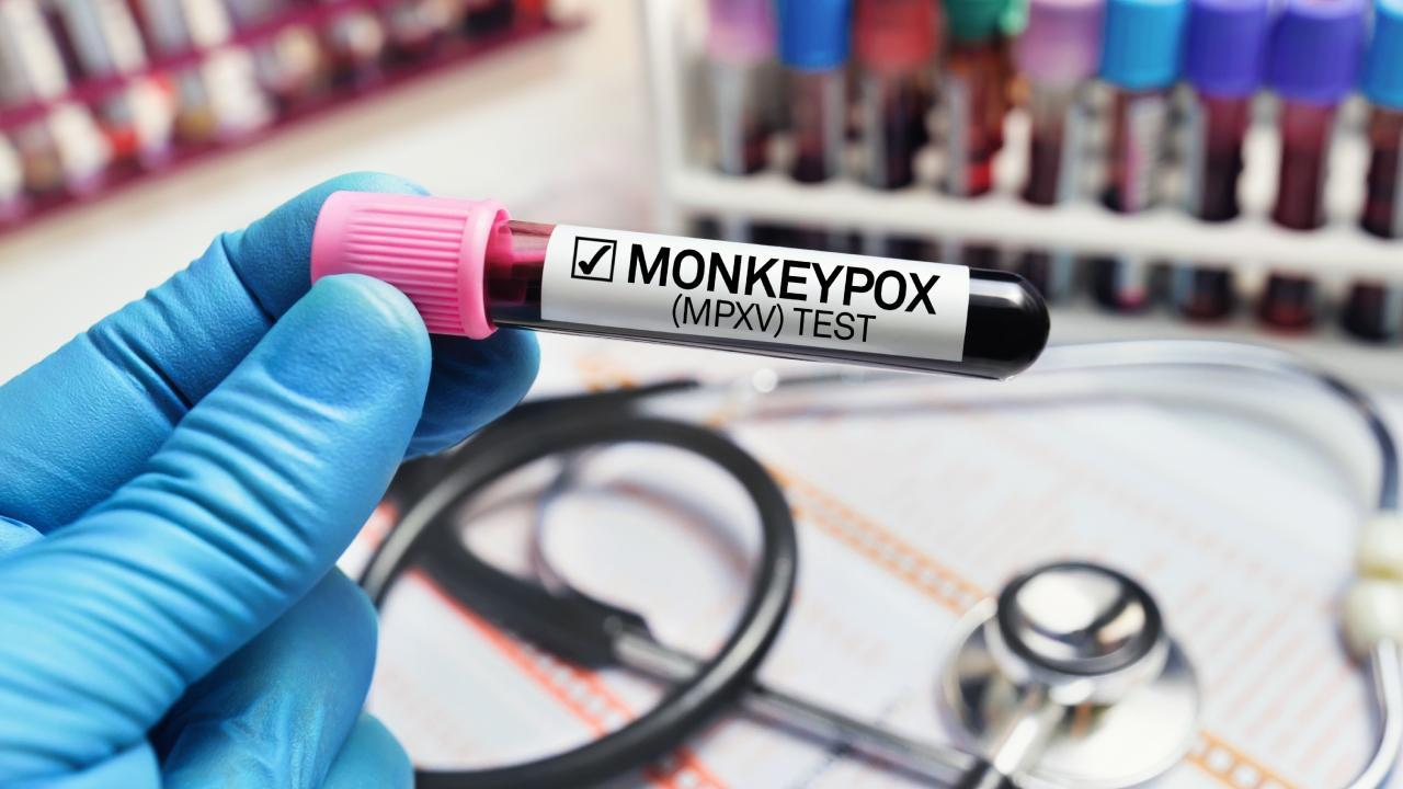 WHO renames monkeypox as mpox, citing racism concerns