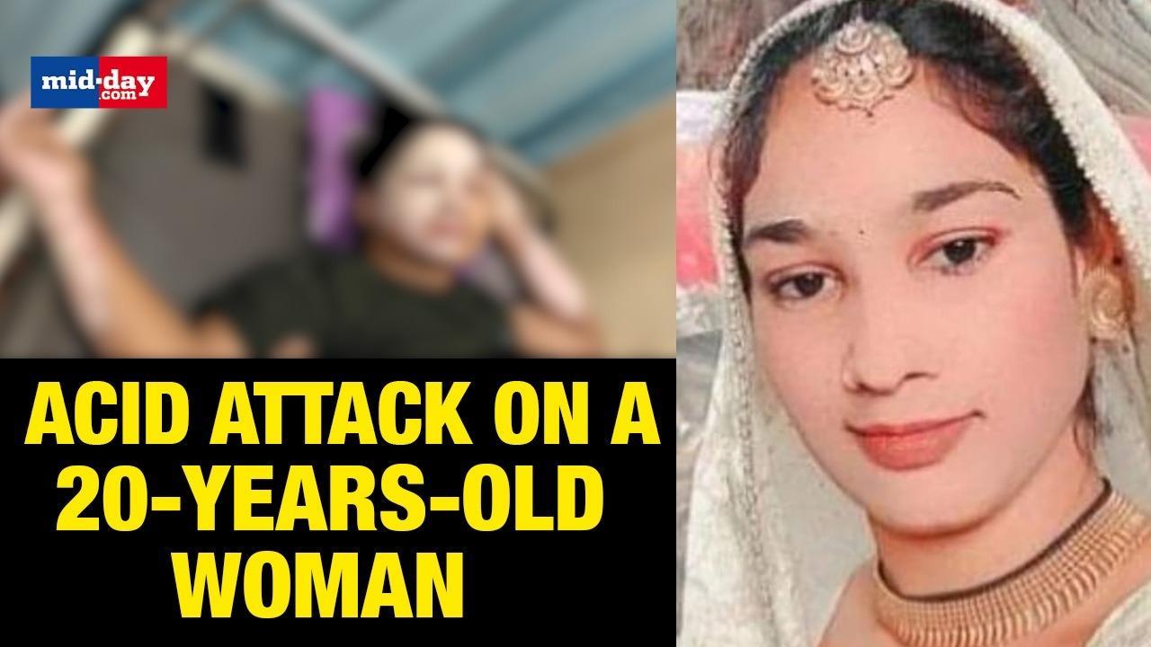Acid Attack on A 20-years-old Woman By Her Husband and Lover