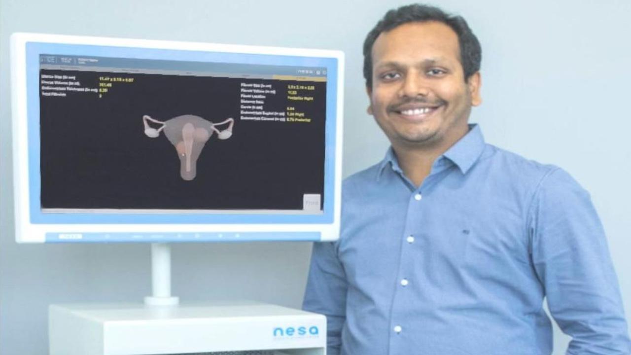 Nesa Medtech pioneers a scar-less solution for uterine fibroids