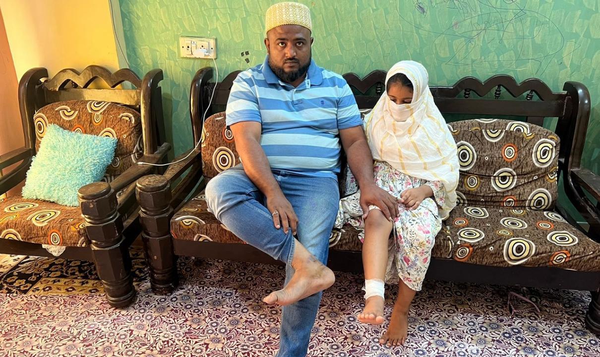 Mumbai: Seven-year-old girl, her father injured after people burst firecrackers on road in Vasai